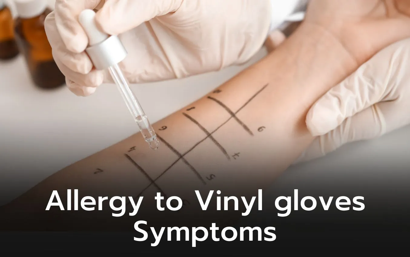 Allergy to Vinyl gloves