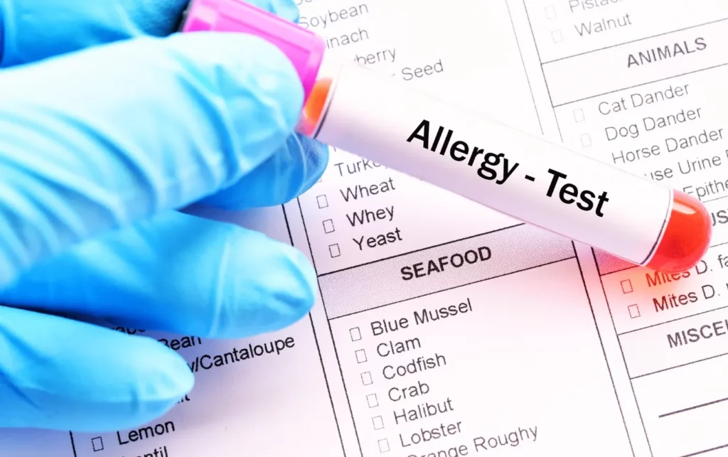 Gloved hand holding allergy test tube near form listing potential allergens including seafood and nuts. "Allergy - Test" is printed on the tube.