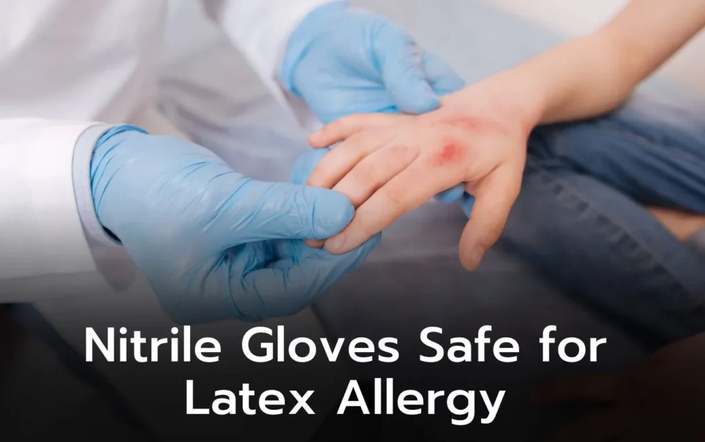Doctor's gloved hands examining a patient's hand with a latex allergy. Nitrile gloves offer a safe alternative.