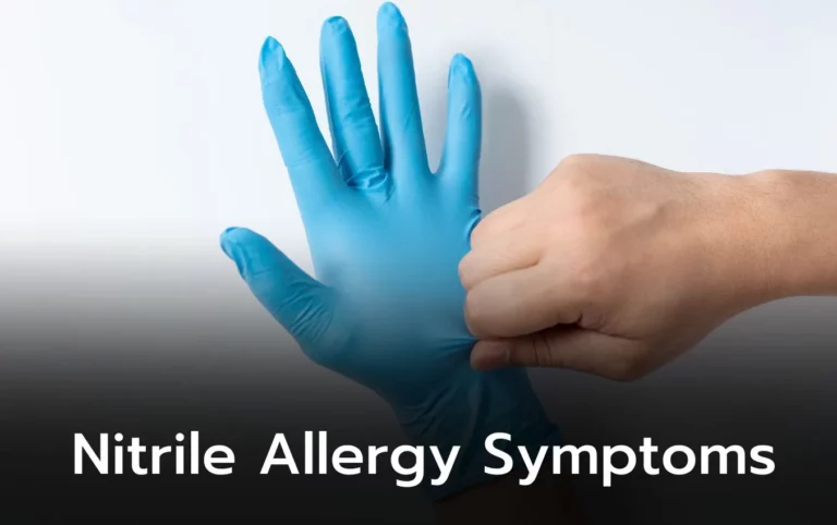 Person putting on a blue nitrile glove, illustrating nitrile allergy symptoms.