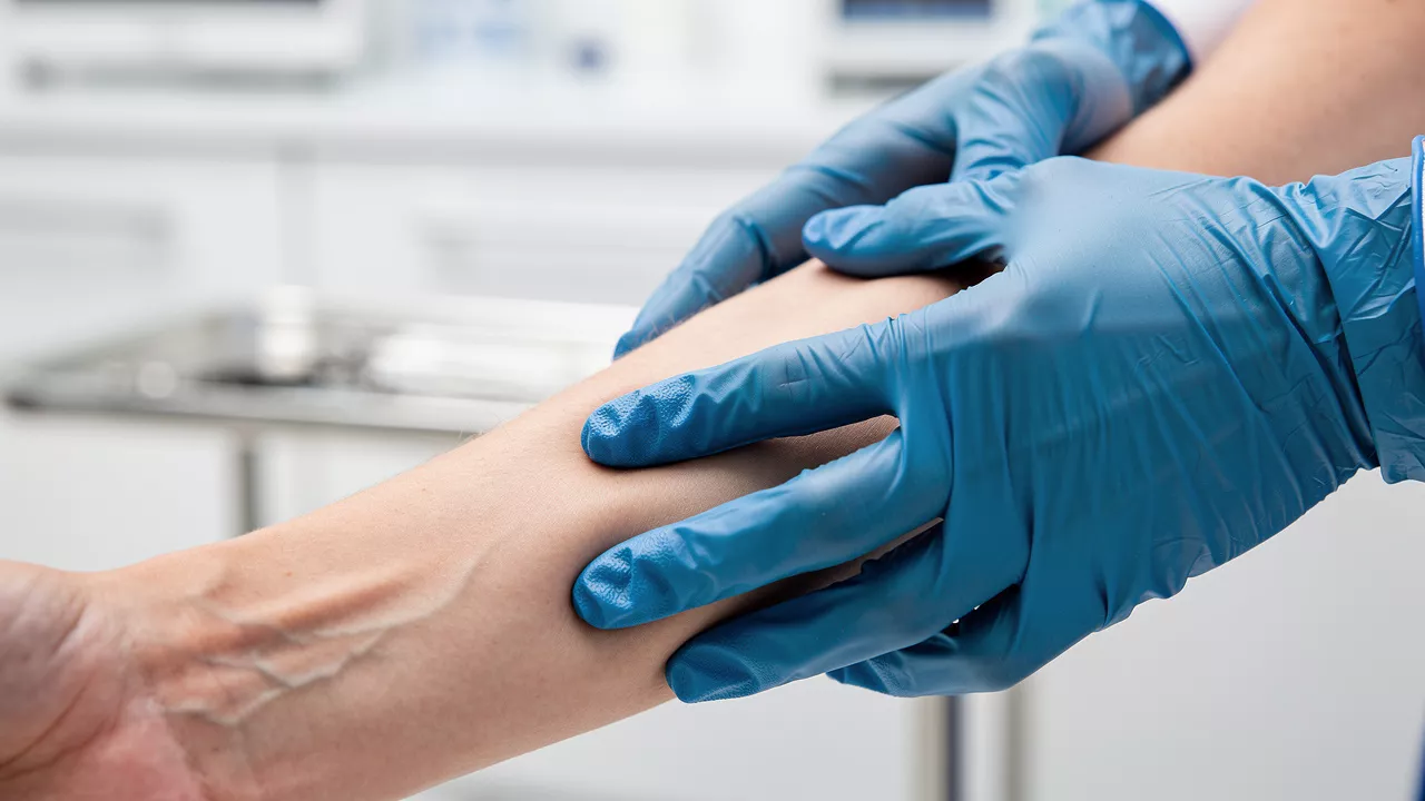 Healthcare professional wearing blue nitrile gloves during patient exam